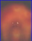 moja aura